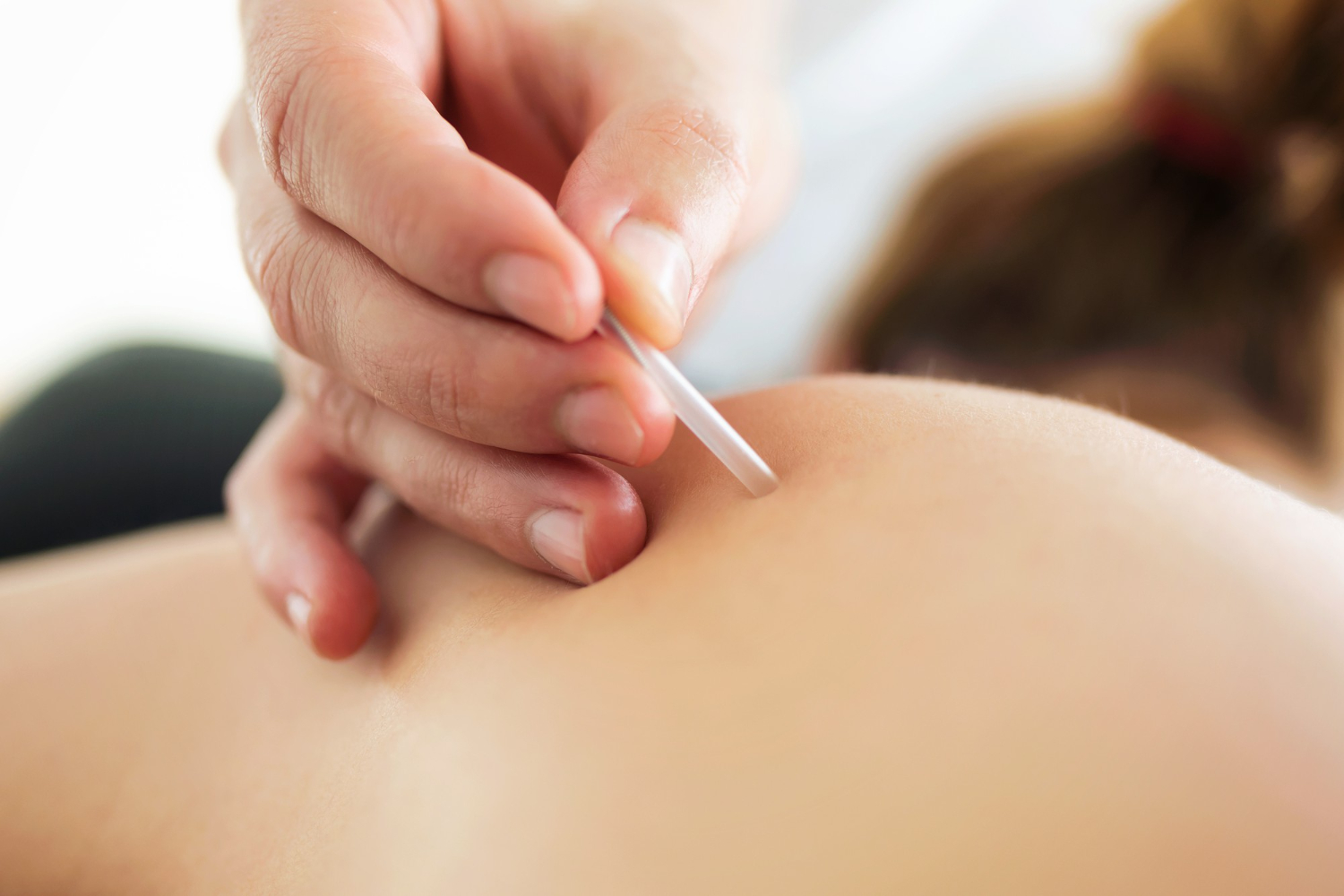 close-up-young-physiotherapist-doing-trigger-point-injection-patient-back
