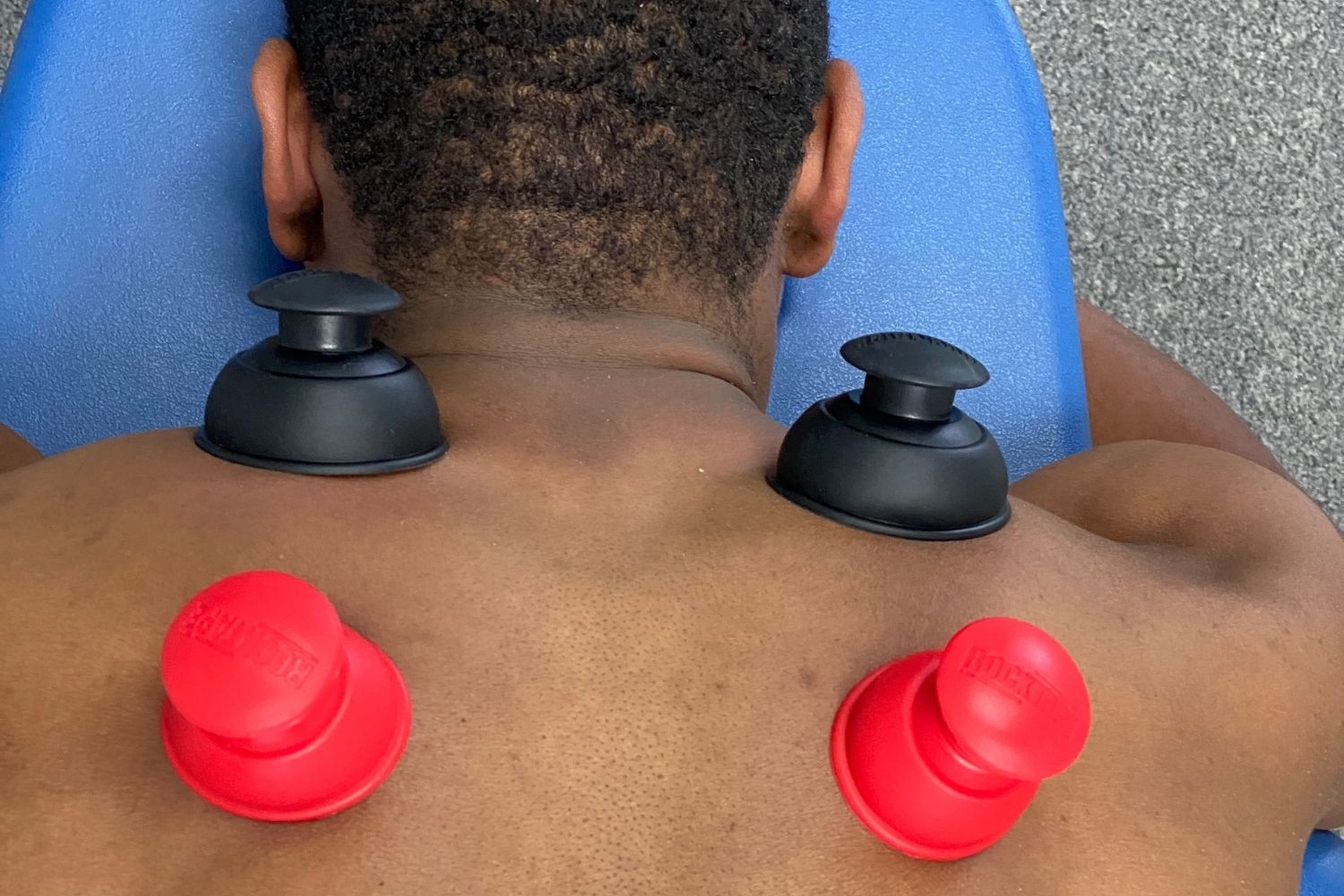 cupping picture cupping image